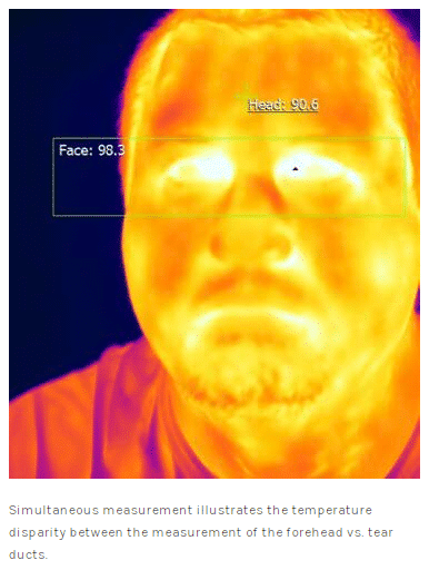 forehead scanner example